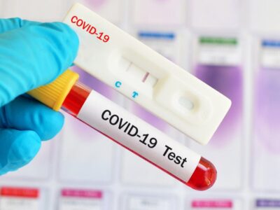 тест на COVID-19 у домашніх умовах і в лабораторії