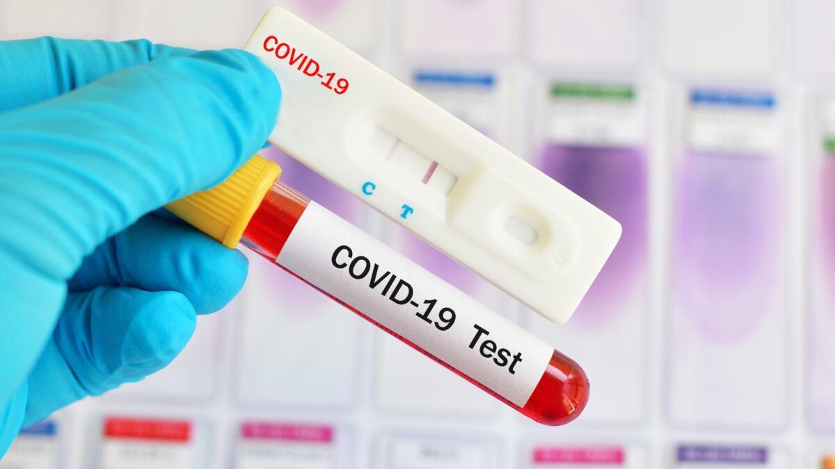 тест на COVID-19 в домашних условиях и в лаборатории