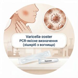 Медична інфографіка для якісного ПЛР-тесту на вірус Varicella-zoster із зображенням висипань, вірусу під мікроскопом та стерильного зонда для зішкрібу з вогнища